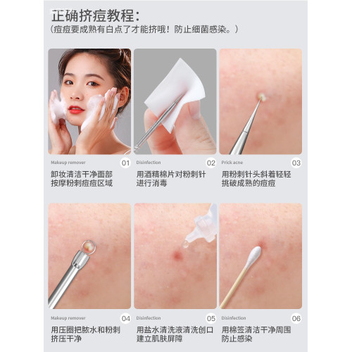 德國材質超細細胞夾粉刺針黑頭針擠痘清閉刮暗瘡美容院專用工具
