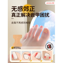 甲溝矯正器日本正甲貼嵌甲腳指甲糾正器專用貼腳趾正甲片甲溝墊炎