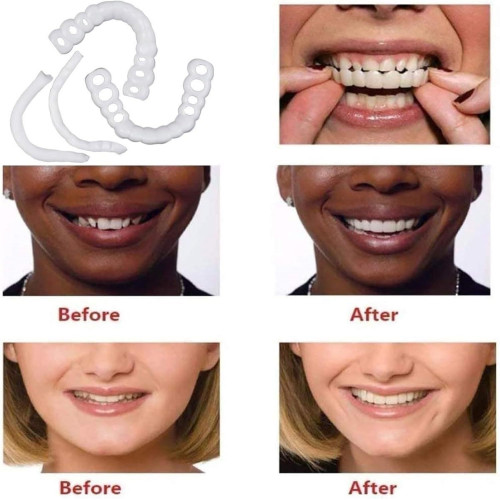 上牙下牙倣真牙套 美白套二代矽膠倣真牙齒假牙套snap on smile